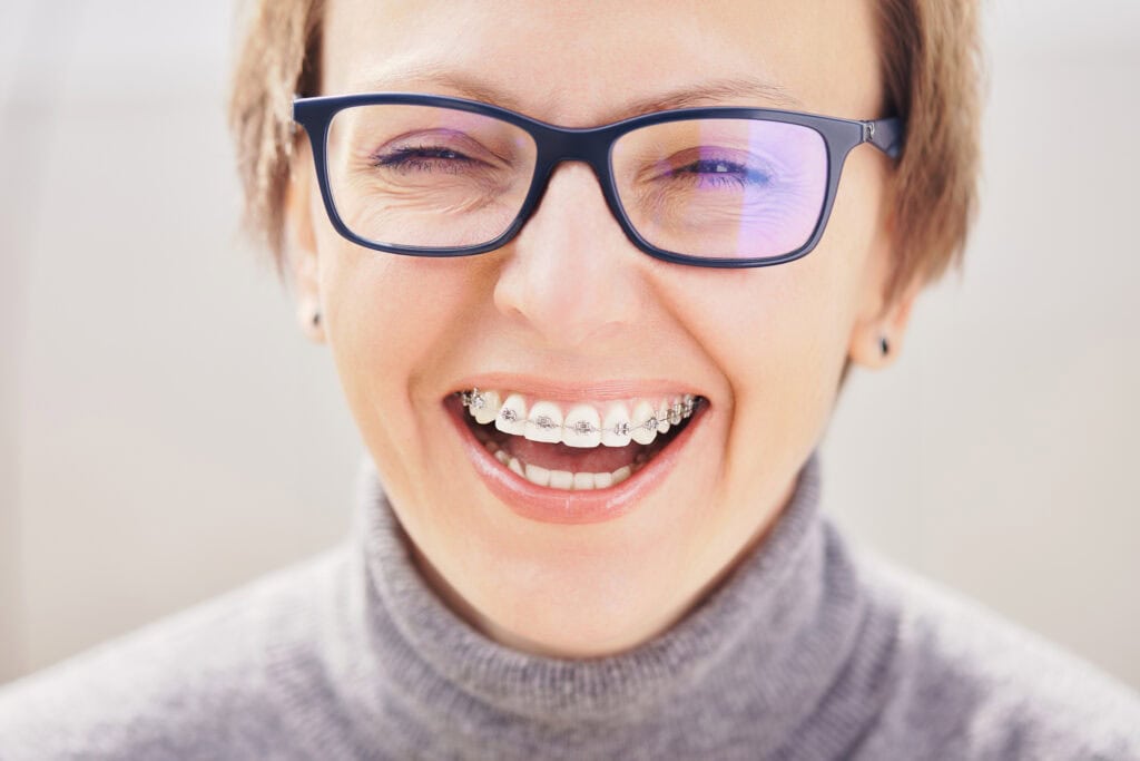 braces in Bellevue